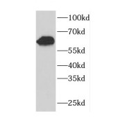 WB analysis of human brain tissue, using CDR2 antibody (1/500 dilution).