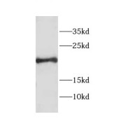 WB analysis of HL-60 cells, using Centrin 1 antibody (1/300 dilution).