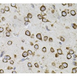Centrosomal Protein 164 kDa (CEP164) Antibody