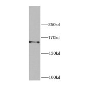 WB analysis of HEK-293 cells, using CEP164 antibody (1/1000 dilution).