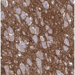 Centrosomal Protein 44 kDa (CEP44) Antibody