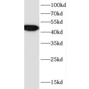 WB analysis of mouse testis tissue, using KIAA1712 antibody (1/1000 dilution).