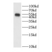 WB analysis of human testis tissue, using CEP55 antibody (1/1000 dilution).