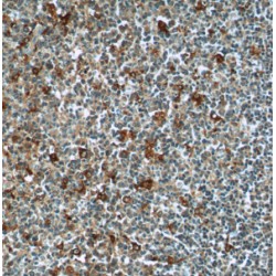 Centrosomal Protein 63 kDa (CEP63) Antibody