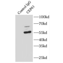 Centrosomal Protein 63 kDa (CEP63) Antibody