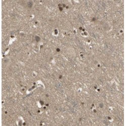 Centrosomal Protein 68 kDa (CEP68) Antibody