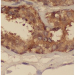 Centrosomal Protein 97 kDa (CEP97) Antibody