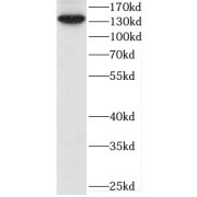 WB analysis of HL-60 cells, using CEP97 antibody (1/1000 dilution).