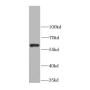 WB analysis of HEK-293 cells, using CES1 antibody (1/1000 dilution).