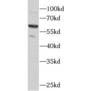 WB analysis of SW620 cells, using CES2 antibody (1/1000 dilution).