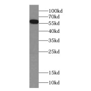 WB analysis of HepG2 cells, using CES7-Specific antibody (1/300 dilution).