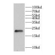 WB analysis of Jurkat cells, using CHAC2 antibody (1/1500 dilution).