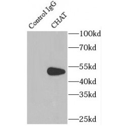 Choline O-Acetyltransferase (CHAT) Antibody