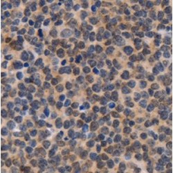 Chromodomain Helicase DNA Binding Protein 2 (CHD2) Antibody