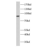 WB analysis of human placenta tissue, using CHD2 antibody (1/500 dilution).