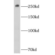 WB analysis of MCF-7 cells, using CHD4 antibody (1/1000 dilution).