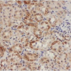 Chromodomain Helicase DNA Binding Protein 9 (CHD9) Antibody