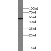 WB analysis of HeLa cells, using CHK1 antibody (1/1000 dilution).