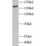 WB analysis of mouse brain tissue, using CHL1 antibody (1/800 dilution).