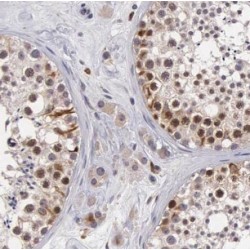 Charged Multivesicular Body Protein 1a (CHMP1A) Antibody