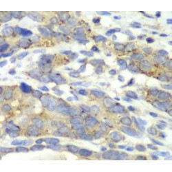 Charged Multivesicular Body Protein 2b (CHMP2B) Antibody