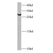 WB analysis of SH-SY5Y cells, using CHMP2B antibody (1/1000 dilution).