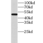 WB analysis of HEK-293 cells, using CHMP7 antibody (1/1000 dilution).