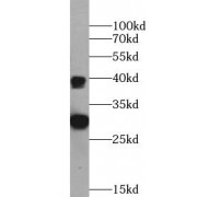 WB analysis of Tunicamycin treated HeLa cells, using CHOP; GADD153 antibody (1/1000 dilution).