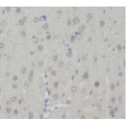 Neuronal Acetylcholine Receptor Subunit Alpha 7 (CHRNA7) Antibody