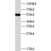 WB analysis of mouse heart tissue, using CHRNA7 antibody (1/1000 dilution).