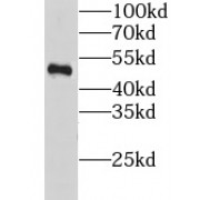 WB analysis of mouse skin tissue, using CHRNA9 antibody (1/1000 dilution).