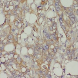 Cholinergic Receptor, Nicotinic Beta 1 (CHRNB1) Antibody