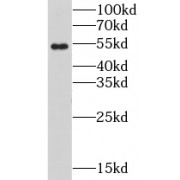 WB analysis of human liver tissue, using CHRNB1 antibody (1/300 dilution).