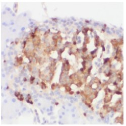 Chromogranin A (CHGA) Antibody