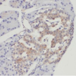 Chromogranin B (CHGB) Antibody
