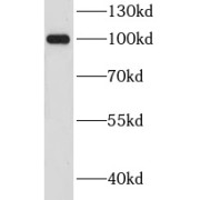 WB analysis of PC-12 cells, using CHGB antibody (1/300 dilution).