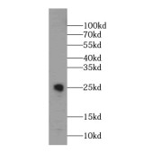 WB analysis of mouse liver tissue, using CHST13-Specific antibody (1/500 dilution).