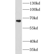 WB analysis of mouse spleen tissue, using CHSY1 antibody (1/500 dilution).