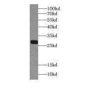 WB analysis of mouse pancreas tissue, using CTRL antibody (1/3000 dilution).