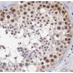 Cellular Inhibitor of Apoptosis 1 (cIAP1) Antibody