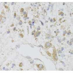 Anamorsin (CIAPIN1) Antibody