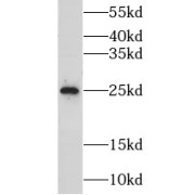 abx231710