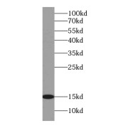 WB analysis of fetal human brain tissue, using CISD2-Specific antibody (1/8000 dilution).