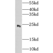 WB analysis of SH-SY5Y cells, using CITED2 antibody (1/500 dilution).