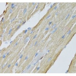 Creatine Kinase, Mitochondrial 2 (CKMT2) Antibody
