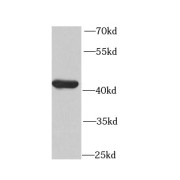 WB analysis of human skeletal muscle tissue, using CKMT2 antibody (1/1000 dilution).