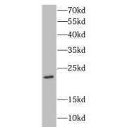 WB analysis of human testis tissue, using CLDN11 antibody (1/500 dilution).