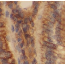 Calcium-Activated Chloride Channel Regulator 2 (CLCA2) Antibody