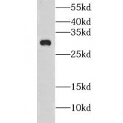WB analysis of mouse brain tissue, using CLEC12B antibody (1/1000 dilution).