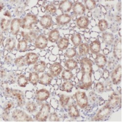 C-Type Lectin Domain Family 18 Member A (CLEC18A) Antibody